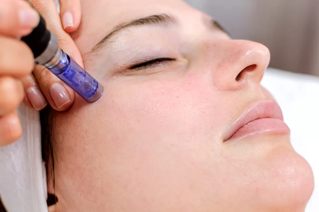 Nano Needling Facial at Ala Care MedSpa for Skin Rejuvenation and Benefits