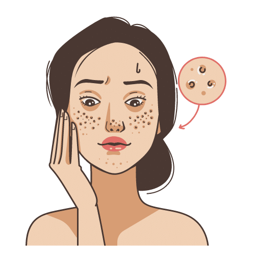 Microneedling Facial at Ala Care MedSpa for Skin Rejuvenation and Benefits