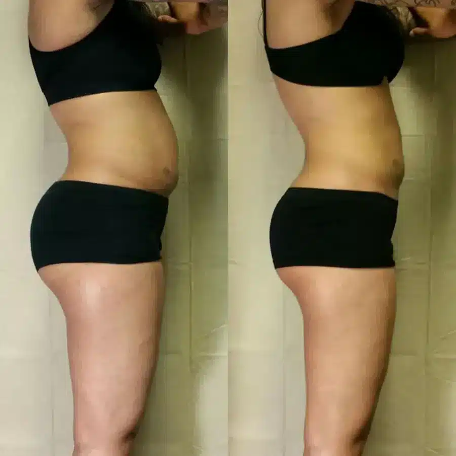 best weight loss program weight loss program near me weight loss injections weight loss clinic near me weight loss clinic | Slim Shot Injections for Weight Loss and Health Benefits at Ala Care MedSpa