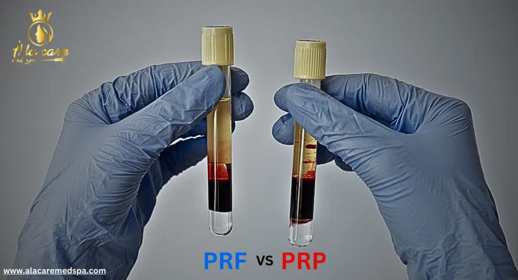 PRP vs PRF