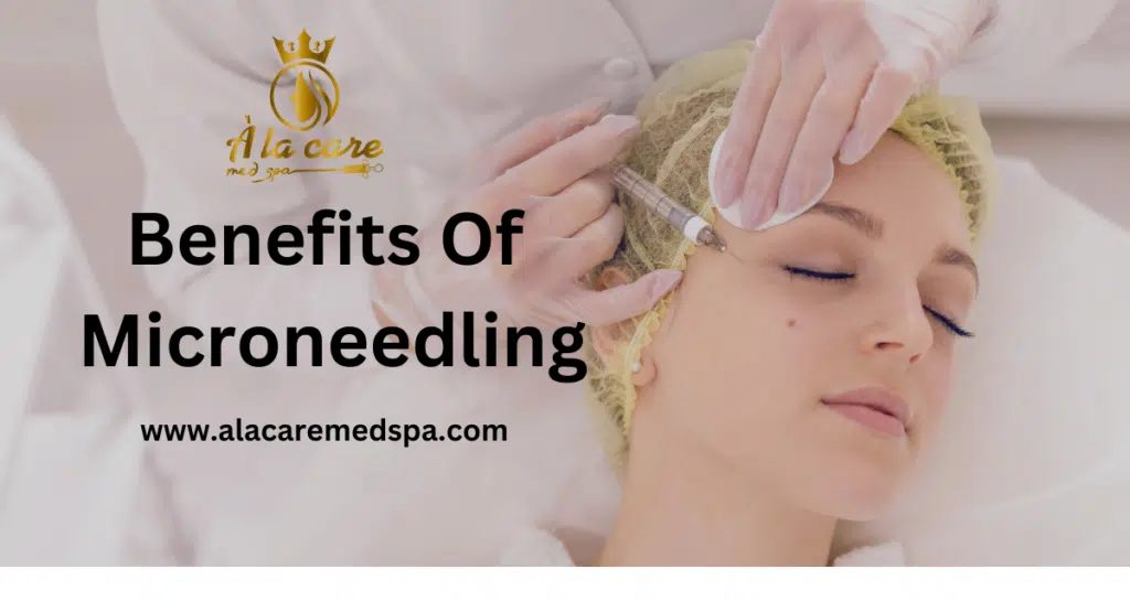Microneedling Benefits