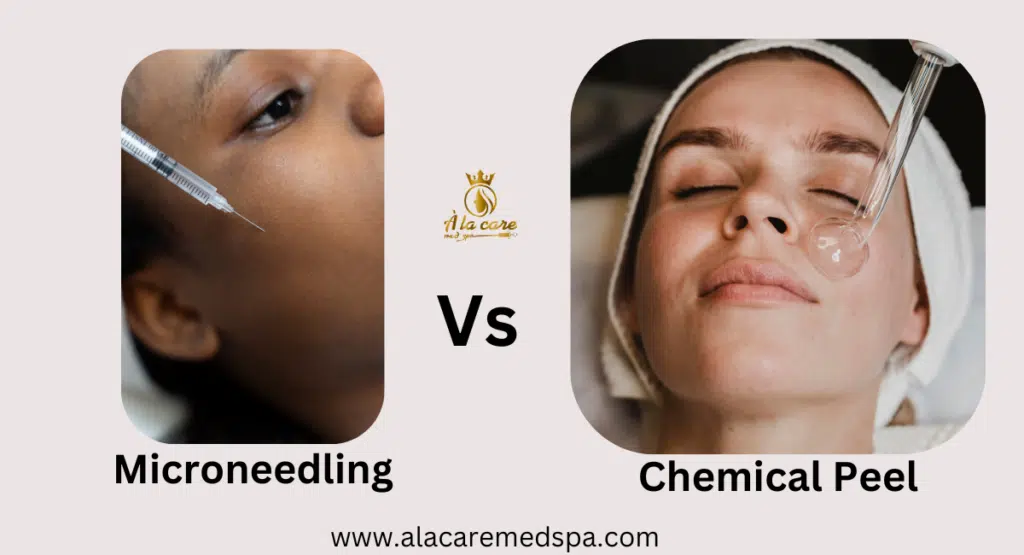 Chemical Peel vs Microneedling