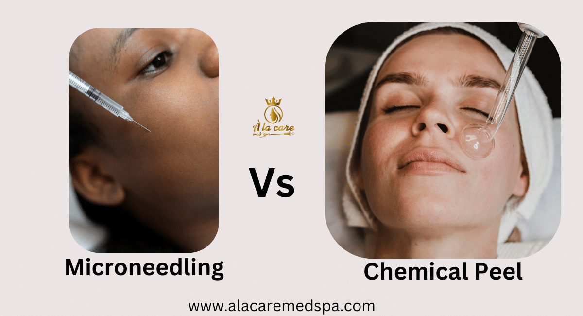 Chemical Peel vs Microneedling